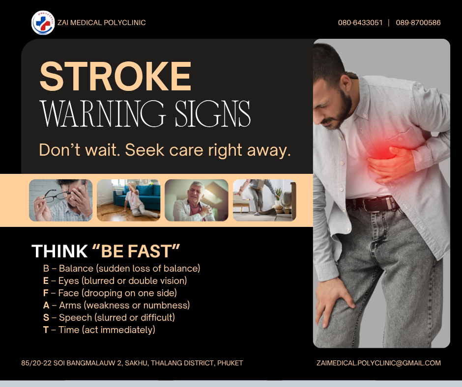 Stroke 